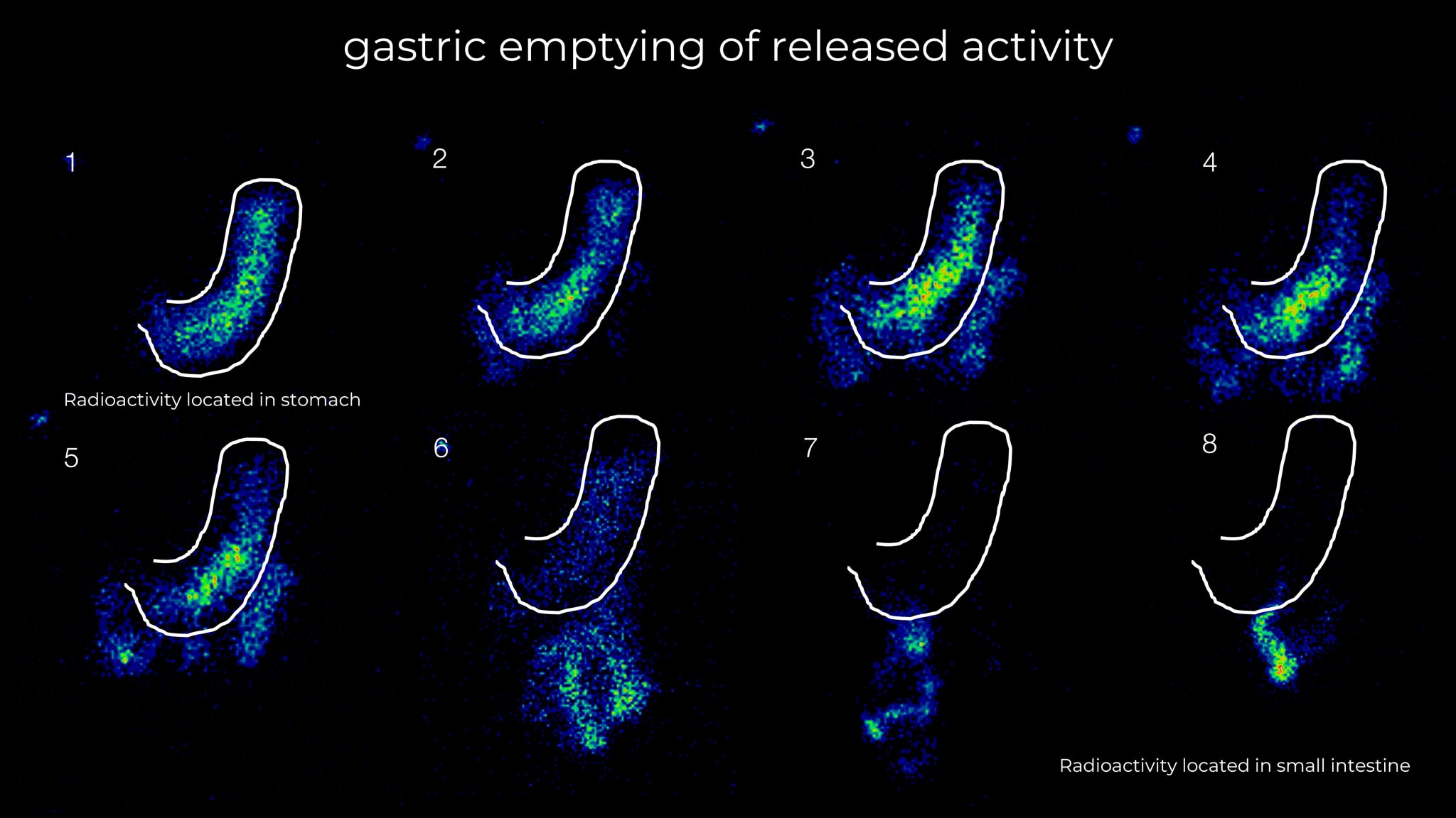 gamma-scintigraphy-imaging-services-scintigraphic-studies